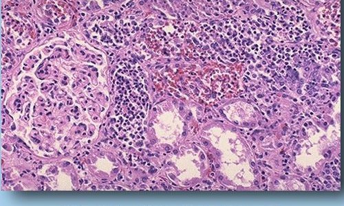 大肚孕妇难产惨叫网 - 为你提供大肚难产影视合集、大肚孕夫怀孕生产难产
